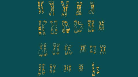 Karyotype of a person with Down's Syndrome