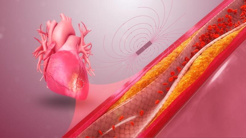 Graphical image of magnetic field around heart