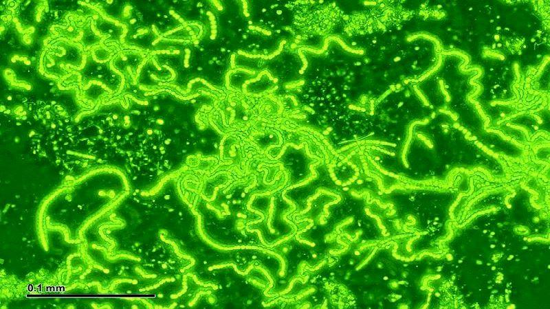 Boosting the protein production in cyanobacteria