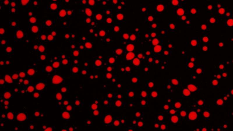 प्रथिनांचे एका द्रावणात तयार झालेले द्रवरूप संघनन दर्शवणारी सूक्ष्मदर्शी प्रतिमा. 