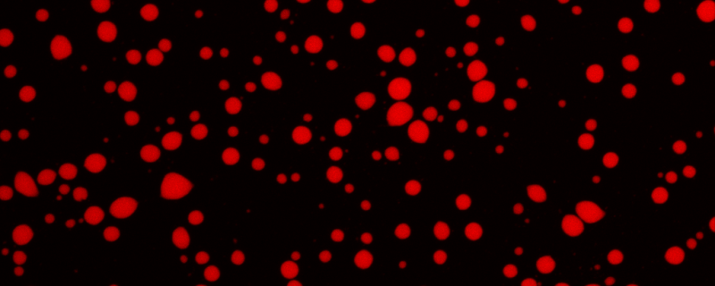  एक विलयन में प्रोटीन द्वारा निर्मित तरल संघनन (लिक्विड कंडेन्सेट) को दर्शाती सूक्ष्मदर्शी छवि।