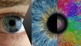 Right image: Human eye (left half) and Radial alignment of cells on a soft inhomogeneous substrate with an embedded glass bead at the center (right half)