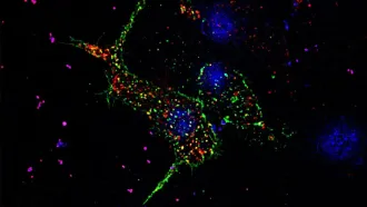A pancreatic beta cell that shows puncta in the form of GLUT transporters in green and insulin granules in red, the nucleus of the cell in blue, taken in super-resolution under Zeiss-Elyra (Credit: Anuma Pallavi)
