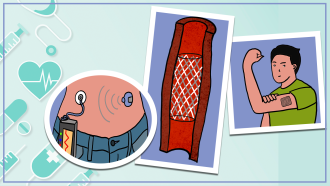 आधुनिक पारिधेय और आरोपण योग्य उपकरण जो कर सकेंगे शरीर में औषधि सम्प्रेषण बनेंगे हमारे तारणहार 