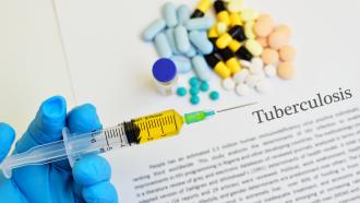 Lungs may still have scars left behind by tuberculosis, shows study