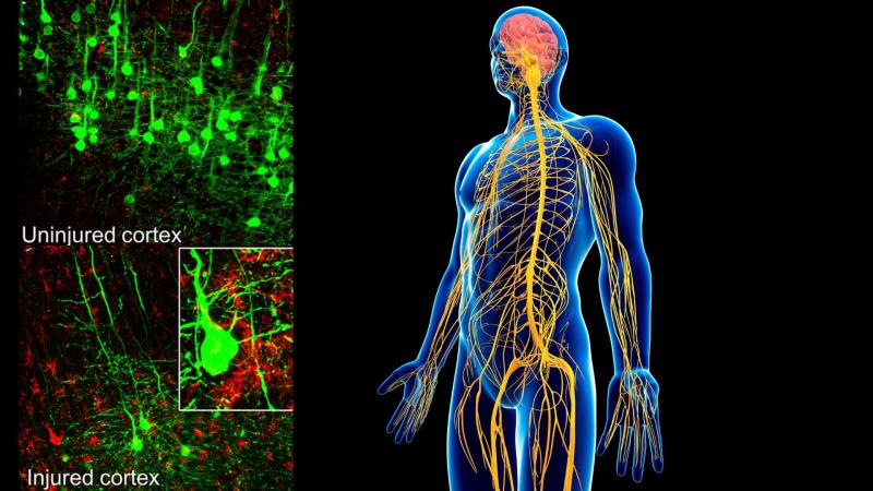 Nervous system with inset images showing injured and uninjuret cortex