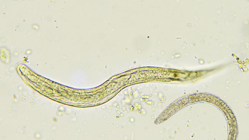 Image of a Roundworm