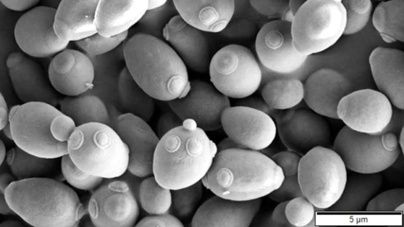 Budding yeast as seen under the microscope. 