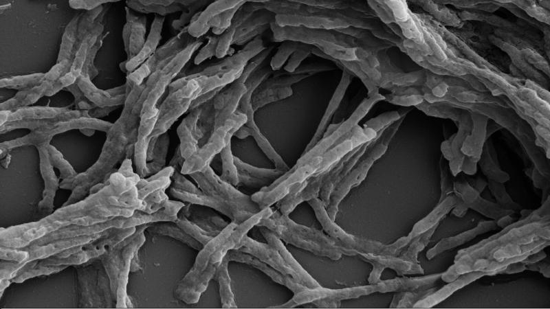 Close Connections: Topoisomerase enzymes, which alleviate DNA stress, connect with critical cell functions