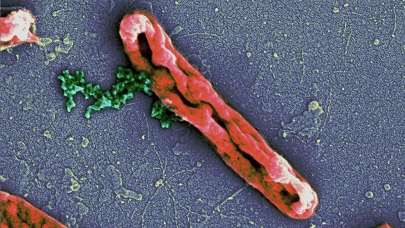 Photo : Deepesh Nagarajan. Antimicrobial peptides disrupting the E. coli cell membrane (orange). The bacterial chromosome (green) can be seen leaking out.