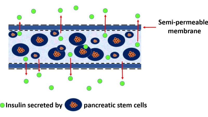 জয়েশ বেল্লাৰে