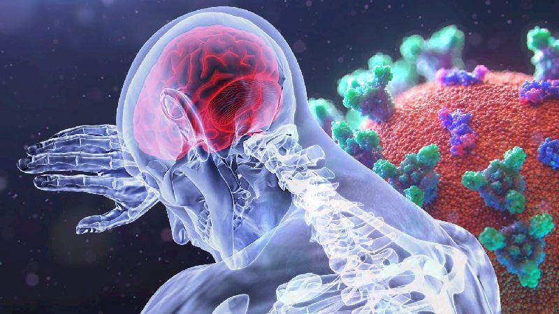 Study finds challenges posed by COVID-19 for stroke care in India