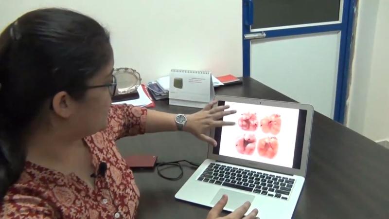 IISc researchers use an anti-malarial drug to increase the effectiveness of anti-tuberculosis drugs