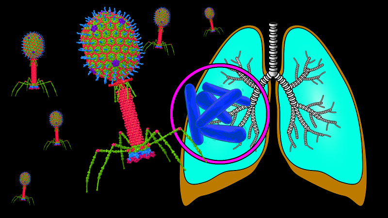 Using viruses to kill Tuberculosis bacteria