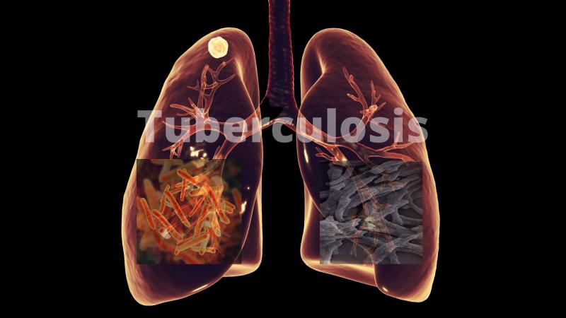 Playing “spot the difference” with two bacterial proteins