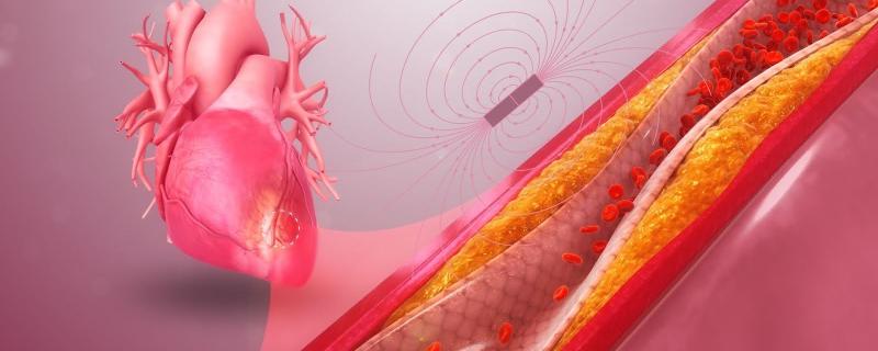 Graphical image of magnetic field around heart