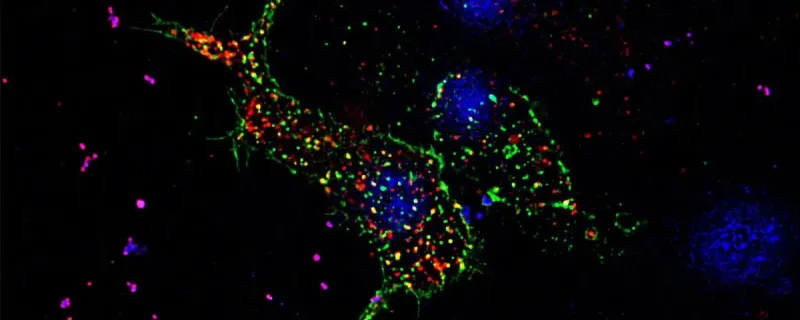 A pancreatic beta cell that shows puncta in the form of GLUT transporters in green and insulin granules in red, the nucleus of the cell in blue, taken in super-resolution under Zeiss-Elyra (Credit: Anuma Pallavi)