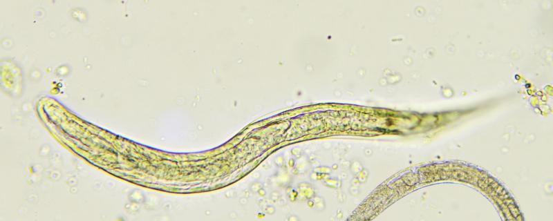 Image of a Roundworm