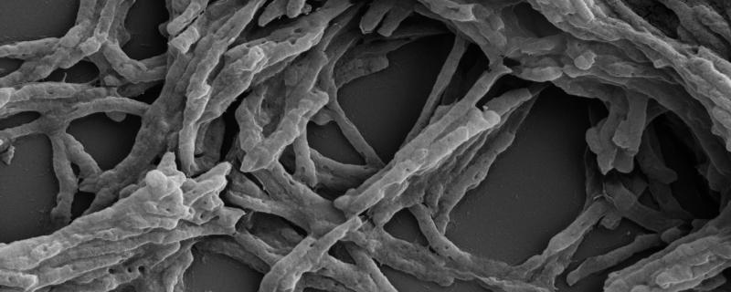 Close Connections: Topoisomerase enzymes, which alleviate DNA stress, connect with critical cell functions