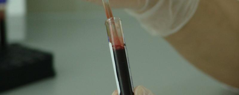 एक संगलित जीन का एक अरब साल पुराना क्रम विकास सम्बन्धी रहस्य सुलझा।