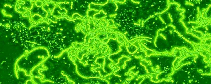 Boosting the protein production in cyanobacteria