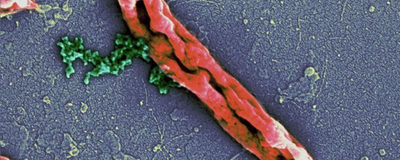 Photo : Deepesh Nagarajan. Antimicrobial peptides disrupting the E. coli cell membrane (orange). The bacterial chromosome (green) can be seen leaking out.