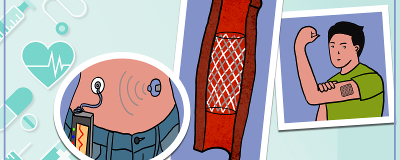 Advanced drug delivery by wearbles and implants: our saviours