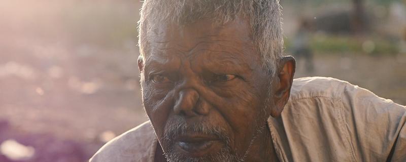 बिहार में प्रचलित कुष्ठ रोग का गलत निदान, अध्ययन में पाया गया