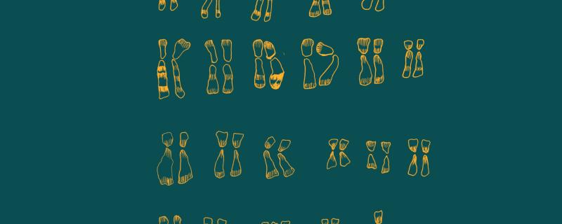 Karyotype of a person with Down's Syndrome