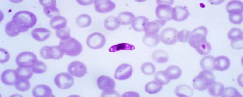 Study explores how blood parasites spread among birds in the Western Ghats