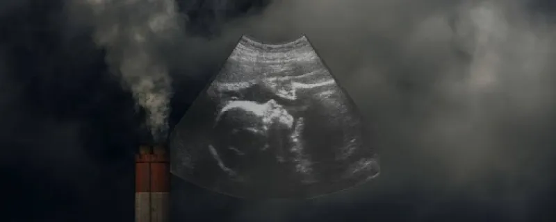 Study Reveals Air Pollution's Adverse Impact on Newborn Health in India