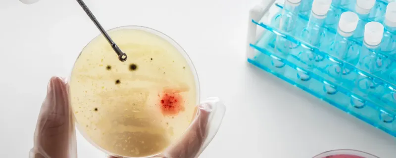 Predicting the Plot: Microbes Hint at Evolution’s Unsolved Question