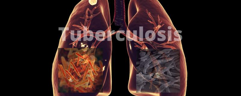 Playing “spot the difference” with two bacterial proteins