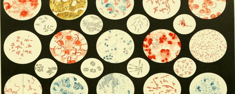 New insights into vaginal microbes may help to reduce premature birth