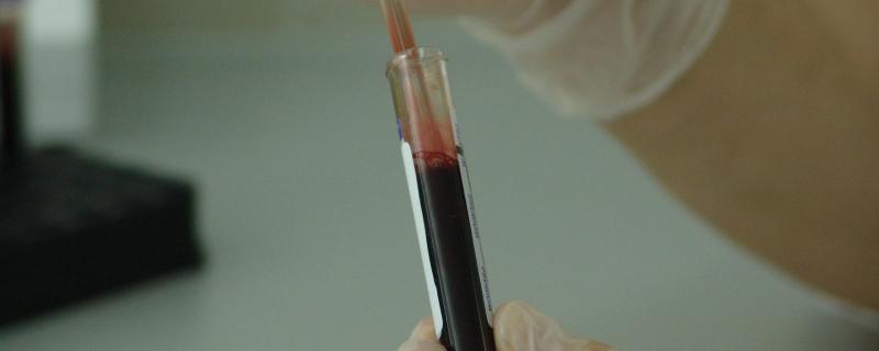 आईआईटी कानपुर के शोधकर्ताओं द्वारा कैंसर के उपचार की दिशा में अनुसंधान